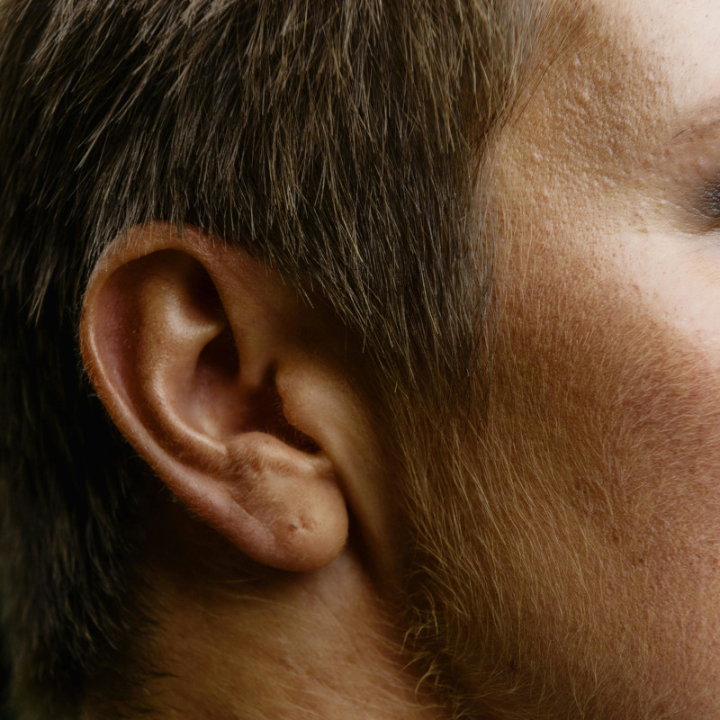 Ear and Nose Cleaning with Wax